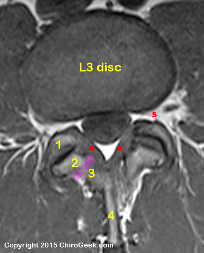 Axial MRI Quiz