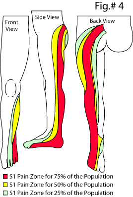 S1 Dermatome