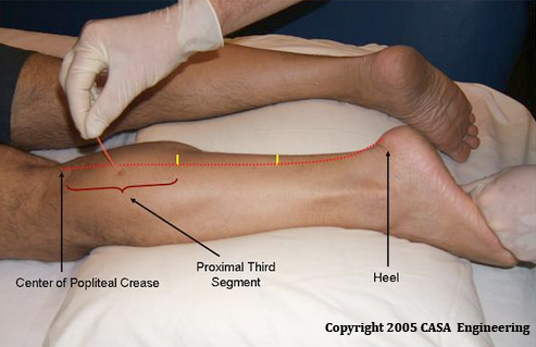 EMG-NCV testing